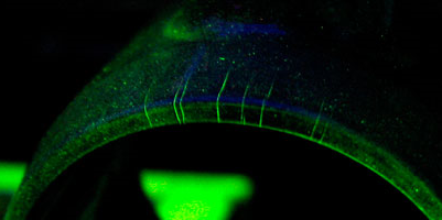 magnetoscopie-bandeau